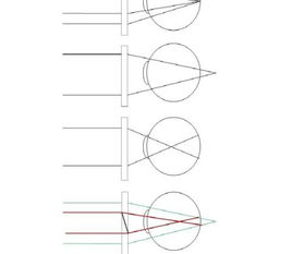 镜片填充设计方案[镜片填充设计方案怎么写]